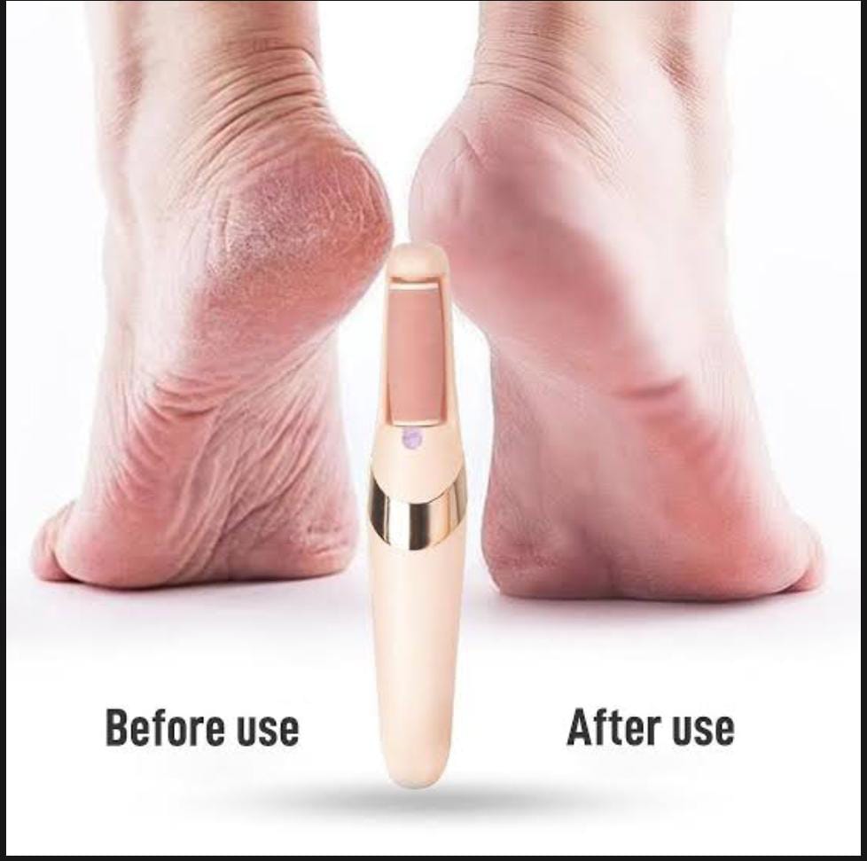 Rechargeable Foot File Remover Pedicure Tool
